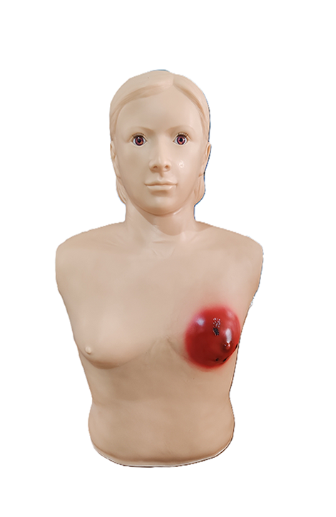 高级乳痈诊断训练模型