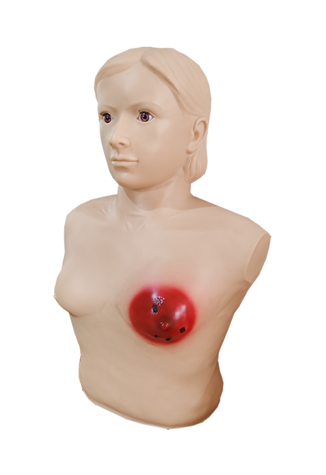 高级乳痈诊断训练模型